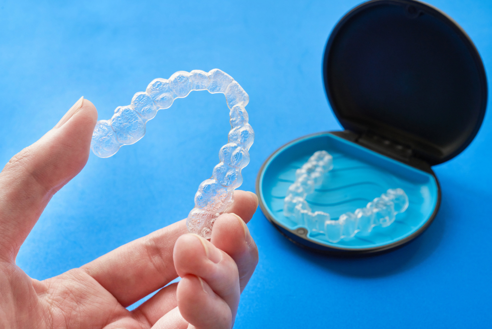 金属アレルギーの方でも安心